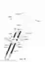 Fig. 53 - Systems for and methods of diagnosing and treating a sacroiliac joint disorder