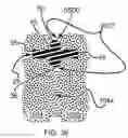 Fig. 62 - Systems for and methods of diagnosing and treating a sacroiliac joint disorder