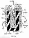 Fig. 64 - Systems for and methods of diagnosing and treating a sacroiliac joint disorder