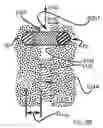 Fig. 66 - Systems for and methods of diagnosing and treating a sacroiliac joint disorder