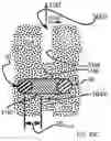Fig. 67 - Systems for and methods of diagnosing and treating a sacroiliac joint disorder