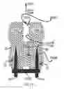 Fig. 69 - Systems for and methods of diagnosing and treating a sacroiliac joint disorder