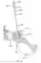 Fig. 70 - Systems for and methods of diagnosing and treating a sacroiliac joint disorder