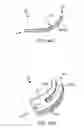 Fig. 77 - Systems for and methods of diagnosing and treating a sacroiliac joint disorder