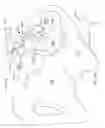 Fig. 78 - Systems for and methods of diagnosing and treating a sacroiliac joint disorder
