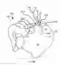 Fig. 79 - Systems for and methods of diagnosing and treating a sacroiliac joint disorder