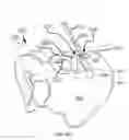 Fig. 80 - Systems for and methods of diagnosing and treating a sacroiliac joint disorder