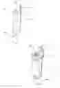 Fig. 02 - KNEE JOINT PROSTHESIS