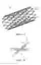 Fig. 02 - INTRAVASCULAR STENT WITH REGIO-SELECTIVE MATERIALS AND STRUCTURES