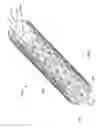 Fig. 02 - Endoluminal stents and methods of delivery