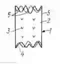 Fig. 01 - DEVICE FOR DEPLOYING A COATED STENT IN BLOOD VESSELS