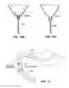 Fig. 09 - Gastro-esophageal implants