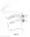 Fig. 22 - Devices, systems and methods for the treatment of sleep apnea