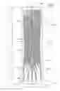 Fig. 02 - Absorbent core with curved and straight absorbent material areas