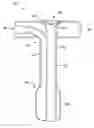 Fig. 01 - GASTROSTOMY DEVICE WITH CONTROLLED SHAPE SILICONE BALLOON
