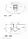 Fig. 35 - IMPLANTS WITH CONTROLLED DRUG DELIVERY FEATURES AND METHODS OF USING SAME