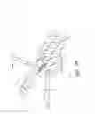 Fig. 69 - IMPLANTS WITH CONTROLLED DRUG DELIVERY FEATURES AND METHODS OF USING SAME