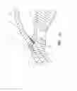 Fig. 71 - IMPLANTS WITH CONTROLLED DRUG DELIVERY FEATURES AND METHODS OF USING SAME