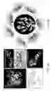 Fig. 07 - Nanoparticle formulations for delivering multiple therapeutic agents