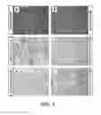 Fig. 07 - Cinacalcet and neuroblastic tumours