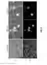 Fig. 09 - METHODS AND COMPOSITIONS FOR TREATING DIABETES WITH IPS DERIVED PANCREATIC BETA-LIKE CELLS