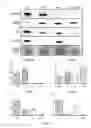Fig. 05 - Treatment of muscular dystrophy