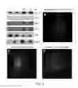 Fig. 06 - Treatment of muscular dystrophy