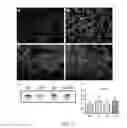 Fig. 08 - Treatment of muscular dystrophy