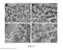 Fig. 10 - Treatment of muscular dystrophy