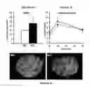 Fig. 06 - Methods for treating metabolic disorders using FGF