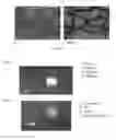 Fig. 06 - COMPOSITIONS AND METHODS FOR TREATMENT OF CERVICAL DYSPLASIA