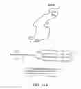 Fig. 85 - GLYCOPEGYLATION METHODS AND PROTEINS/PEPTIDES PRODUCED BY THE METHODS