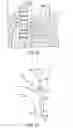 Fig. 16 - System and method for treatment of pulmonary edema