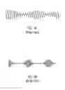 Fig. 02 - Detection of periodic breathing during CPAP therapy
