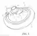 Fig. 02 - Mask with Tang Protrusions for Improved Grasping Ability