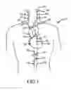 Fig. 02 - Augmented delivery catheter and method