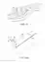 Fig. 22 - Implanting an electrode array against the spinal cord inside the dura for stimulating the spinal cord and treating pain