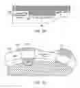 Fig. 33 - Implanting an electrode array against the spinal cord inside the dura for stimulating the spinal cord and treating pain