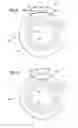 Fig. 09 - Pulse jet air cleaner systems, components, and, methods