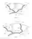 Fig. 32 - Customizable apparatus and method for transporting and depositing fluids