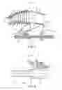 Fig. 04 - Disassembly method for a gas turbine