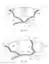 Fig. 32 - Customizable apparatus and method for transporting and depositing fluids