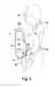 Fig. 07 - Child transport device