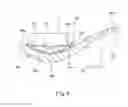 Fig. 06 - Railcar bogie