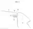 Fig. 03 - Structure for fixing motor vehicle roof module