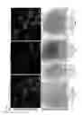 Fig. 04 - Platelet targeted treatment