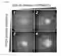 Fig. 18 - Methods, kits, and compositions for stem cell self-renewal