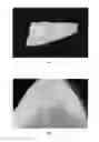 Fig. 02 - Method For Production Of Large Numbers Of Cartilage Cells With Phenotype Retention