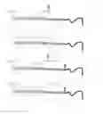 Fig. 05 - Coagulation factor IX compositions and methods of making and using same