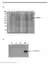 Fig. 05 - Polynucleotide for recombinant expression of isomaltulose synthase